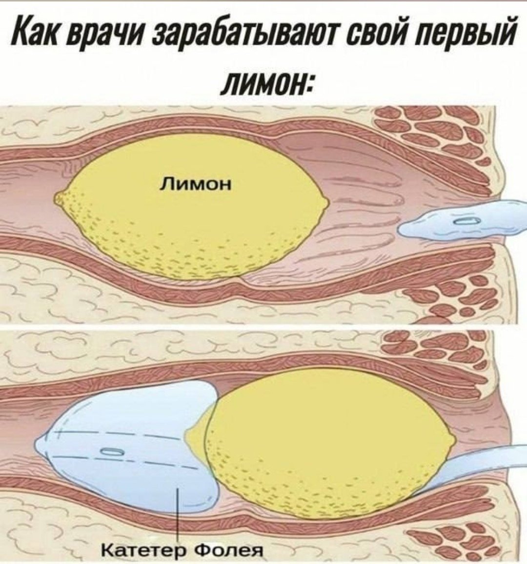 Заяцените прекол — Feanor · Стрекоза