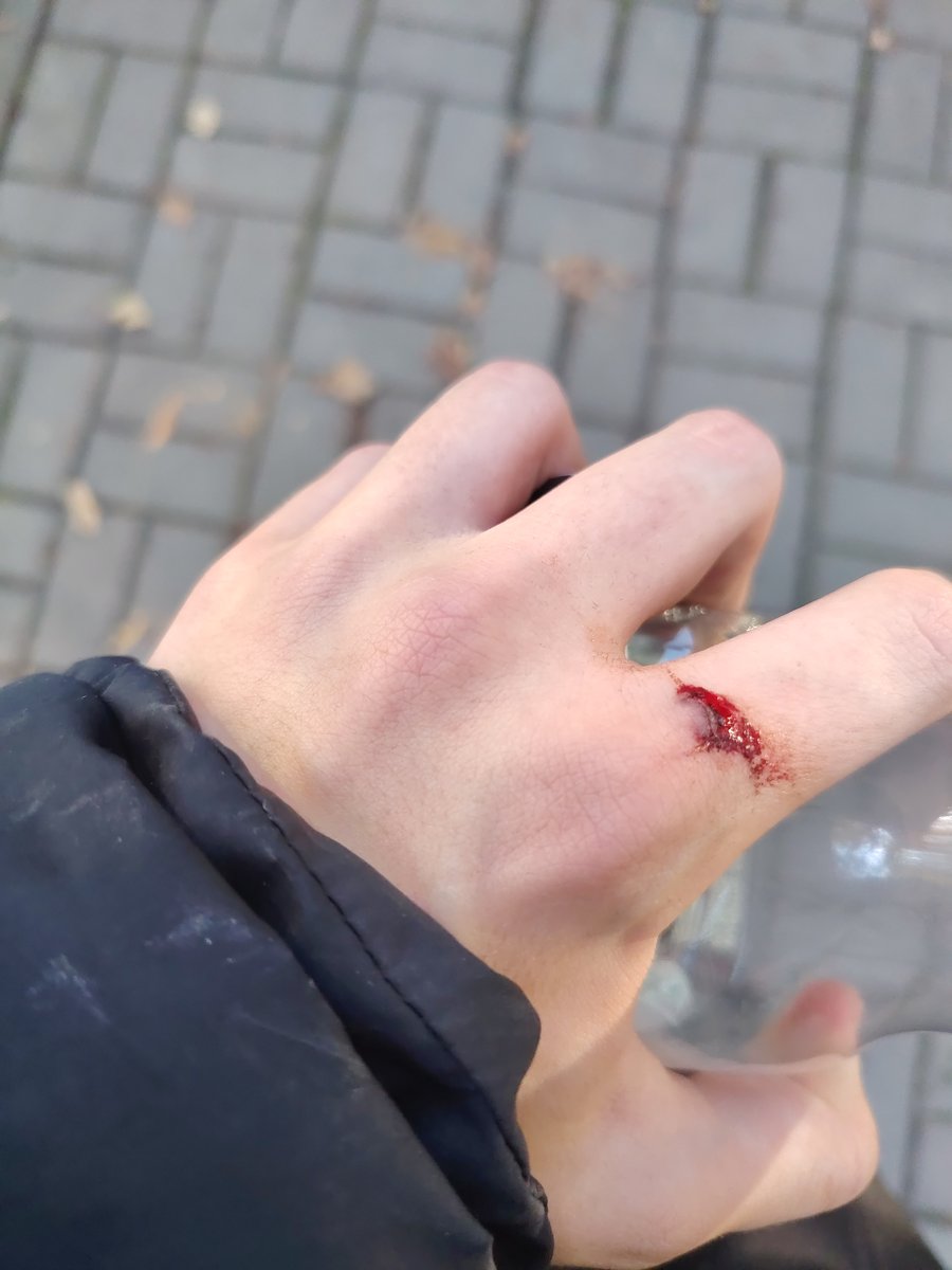 Я палец разхерачил об комод пока в теннис играл пхпз — 1loveChesee · Стрекоза
