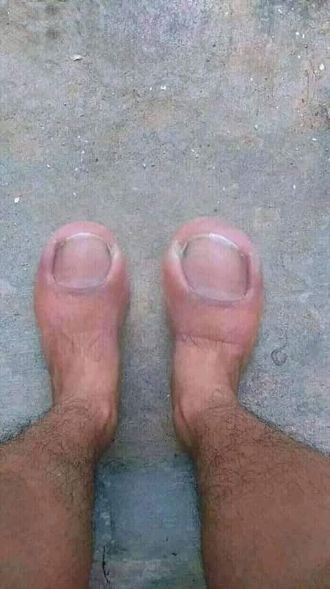 p@Lch1k1)) стоп.. какие это пальчики?! это же большие пальцы! блин, к… — upyach.ka · Стрекоза